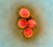 Ученые обнаружили, что COVID-19 научился обходить антитела